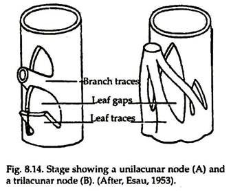 Stage Showing a Unilacunar Node and a Trilacunar Node